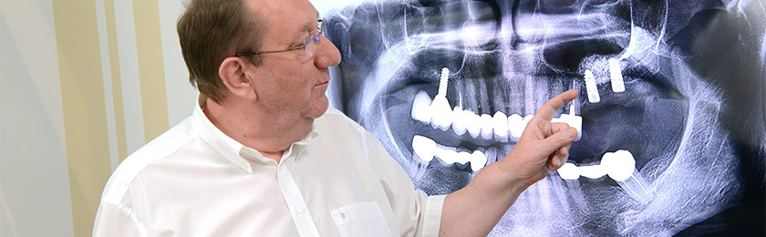 Zahnimplantate (Implantologie)